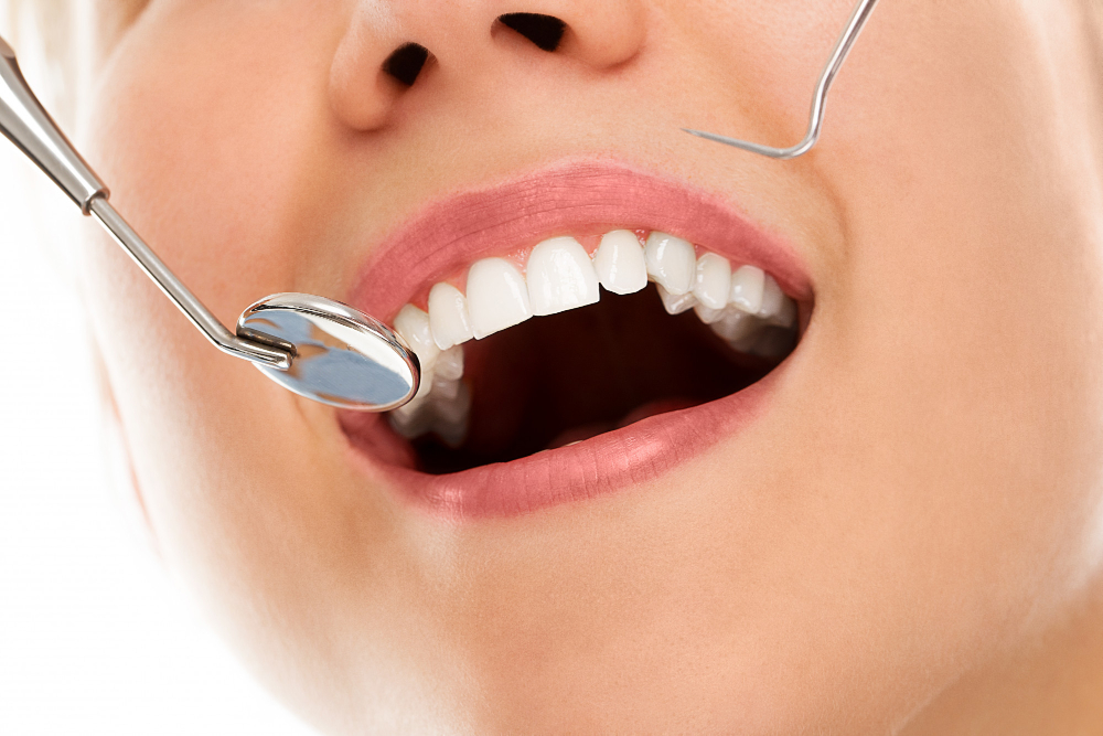 femme chez le dentiste